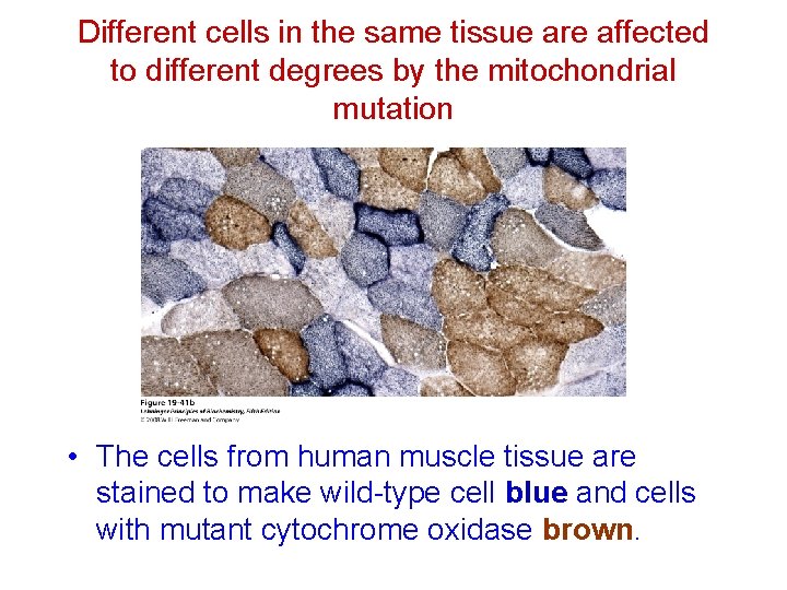 Different cells in the same tissue are affected to different degrees by the mitochondrial
