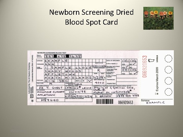 Newborn Screening Dried Blood Spot Card 05/12/2020 