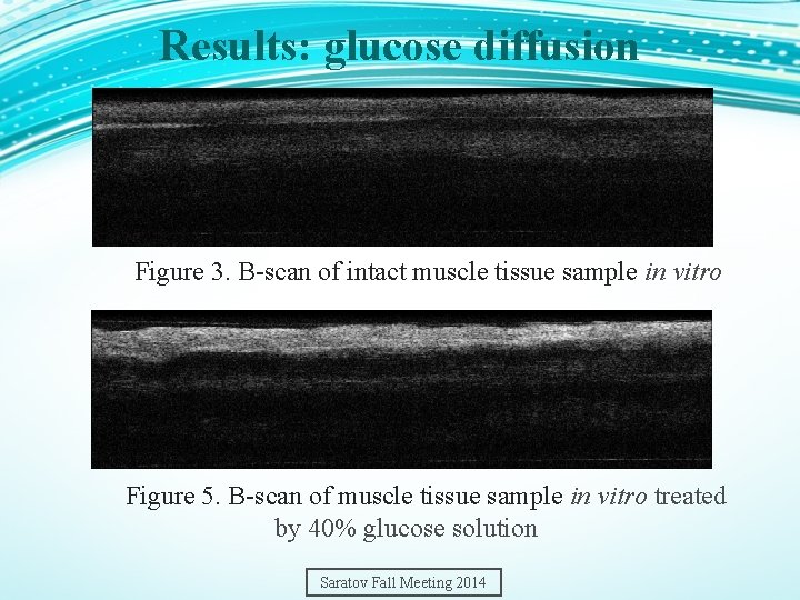 Results: glucose diffusion Figure 3. B-scan of intact muscle tissue sample in vitro Figure