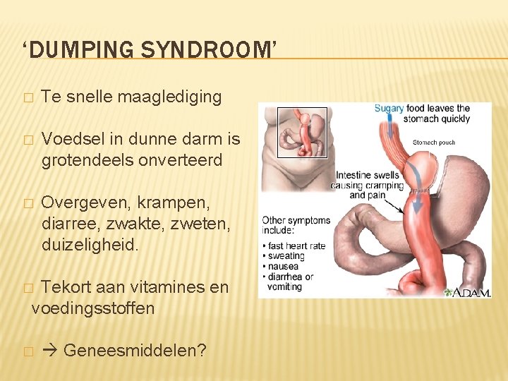 ‘DUMPING SYNDROOM’ � Te snelle maaglediging � Voedsel in dunne darm is grotendeels onverteerd