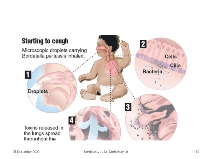 05 December 2020 Bordetella by Dr. Mohsina Haq 10 