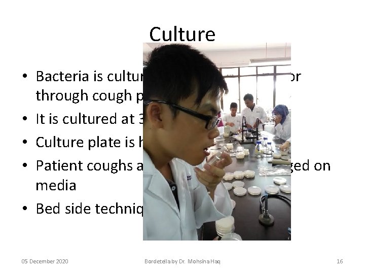 Culture • Bacteria is cultures either from swabs or through cough plate methods •