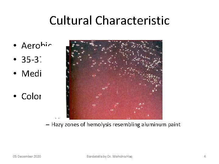 Cultural Characteristic • Aerobic • 35 -37 C • Medium – Bordet Gengou agar