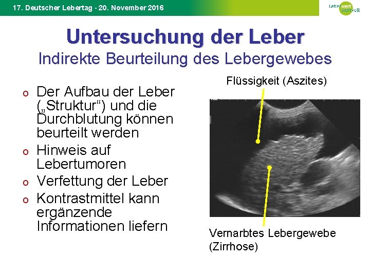 17. Deutscher Lebertag - 20. November 2016 Untersuchung der Leber Indirekte Beurteilung des Lebergewebes