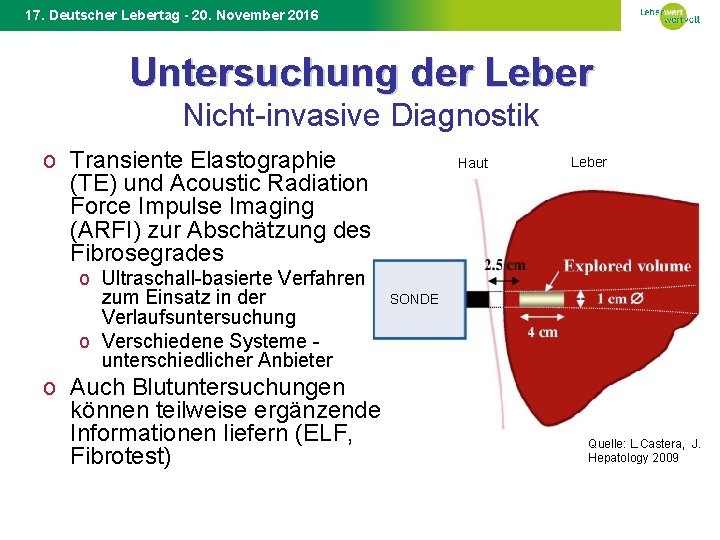 17. Deutscher Lebertag - 20. November 2016 Untersuchung der Leber Nicht-invasive Diagnostik o Transiente