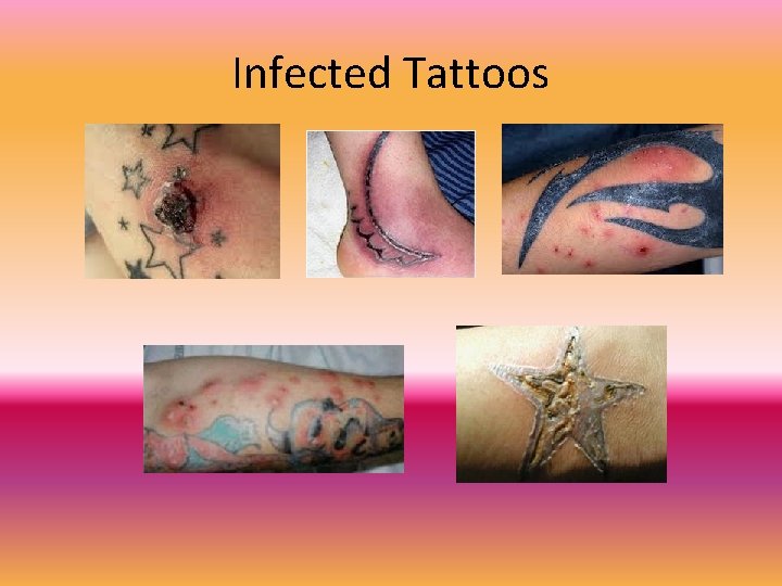 Infected Tattoos 