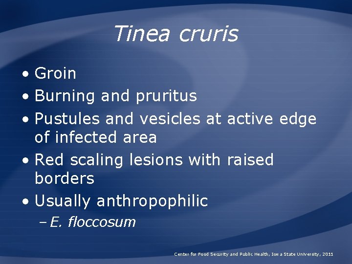 Tinea cruris • Groin • Burning and pruritus • Pustules and vesicles at active