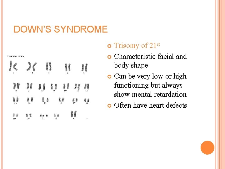 DOWN’S SYNDROME Trisomy of 21 st Characteristic facial and body shape Can be very