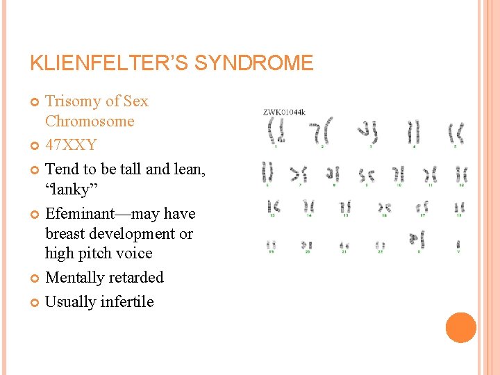 KLIENFELTER’S SYNDROME Trisomy of Sex Chromosome 47 XXY Tend to be tall and lean,