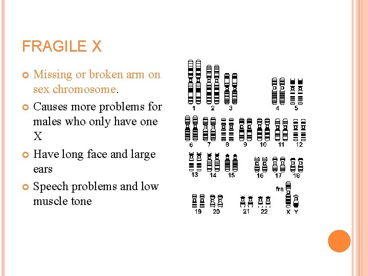 FRAGILE X Missing or broken arm on sex chromosome. Causes more problems for males