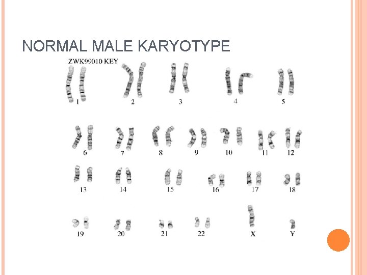 NORMAL MALE KARYOTYPE 