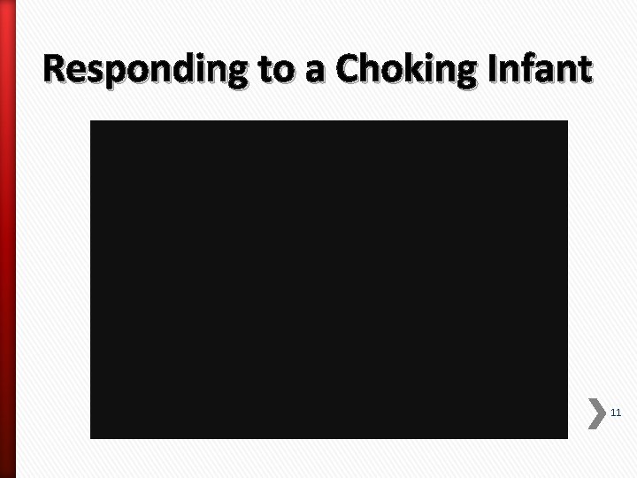 Responding to a Choking Infant 11 