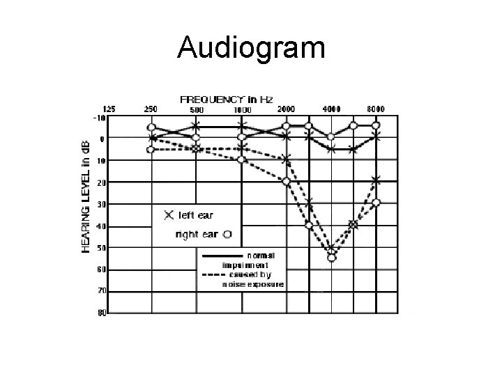 Audiogram Audiogram