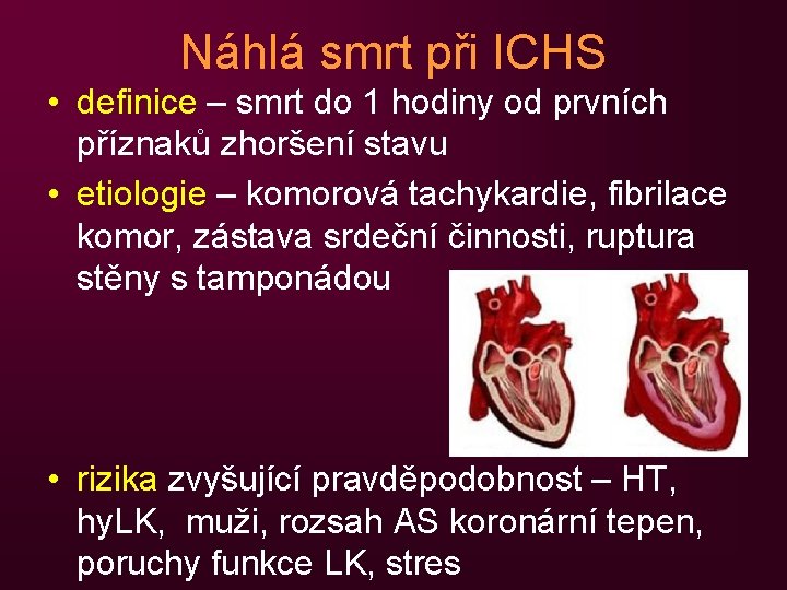 Náhlá smrt při ICHS • definice – smrt do 1 hodiny od prvních příznaků