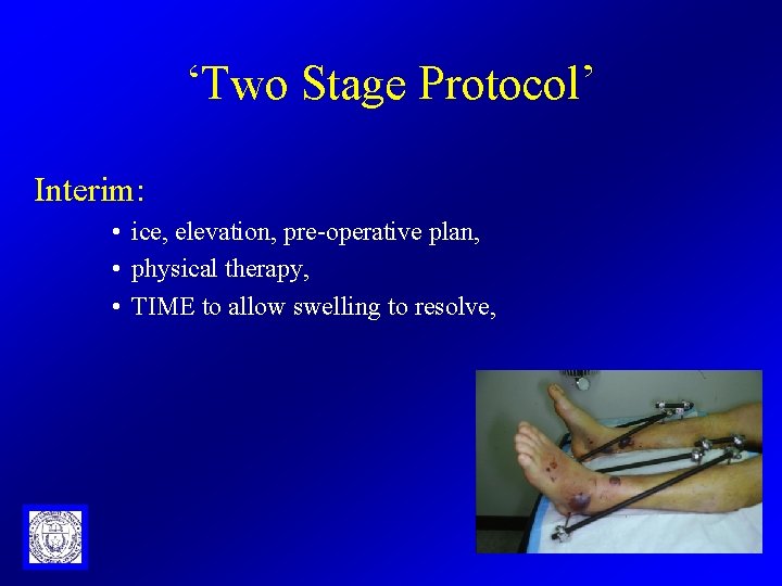 ‘Two Stage Protocol’ Interim: • ice, elevation, pre-operative plan, • physical therapy, • TIME