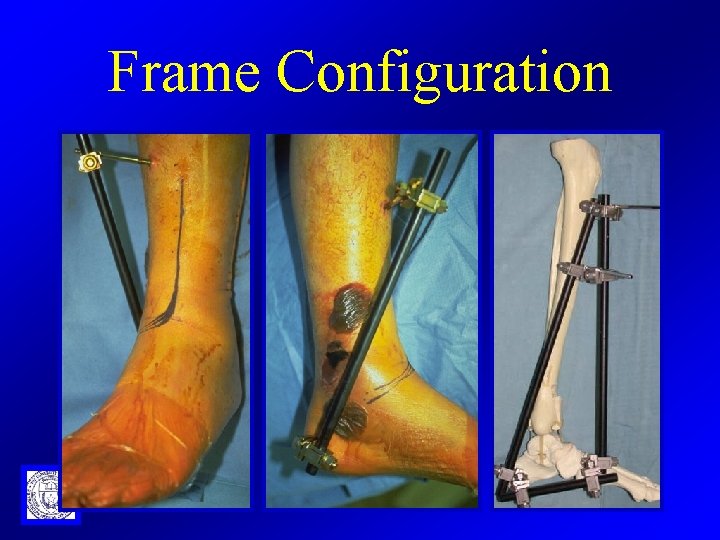 Frame Configuration 