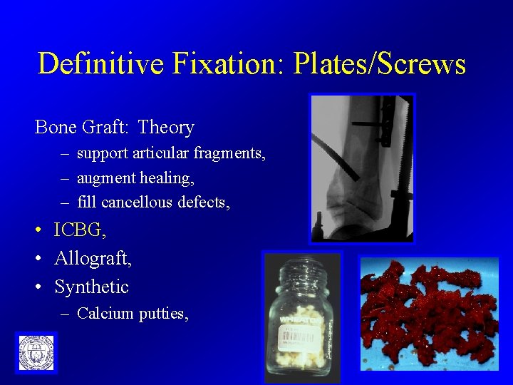 Definitive Fixation: Plates/Screws Bone Graft: Theory – support articular fragments, – augment healing, –