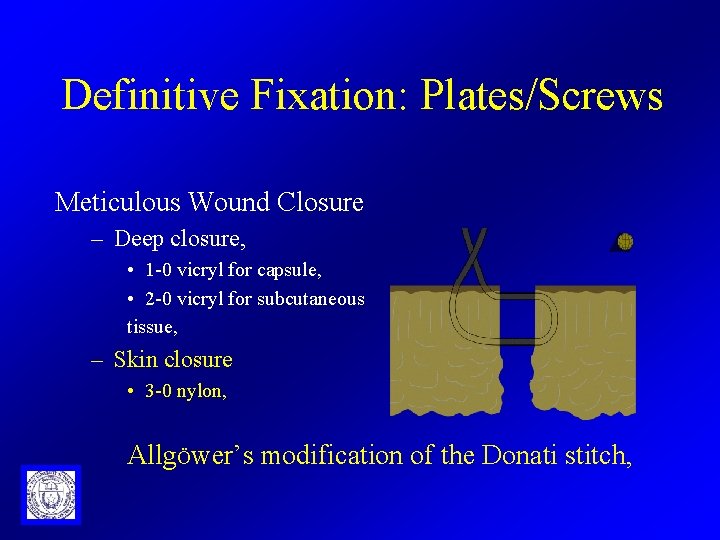 Definitive Fixation: Plates/Screws Meticulous Wound Closure – Deep closure, • 1 -0 vicryl for