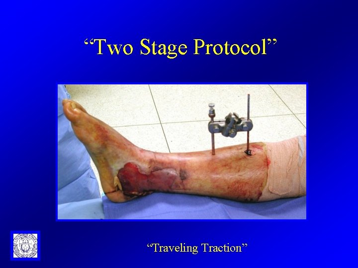 “Two Stage Protocol” “Traveling Traction” 