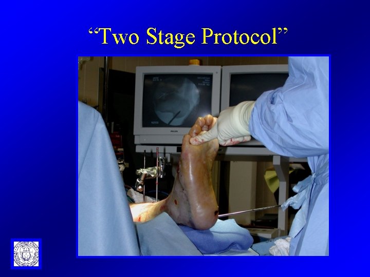 “Two Stage Protocol” 