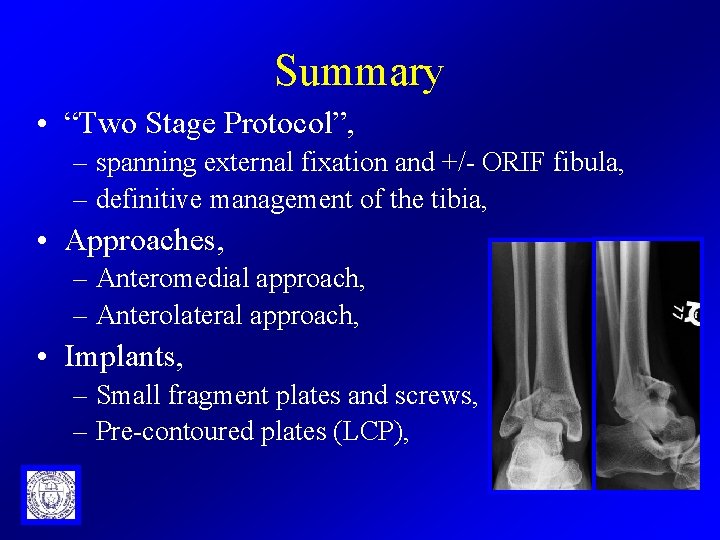 Summary • “Two Stage Protocol”, – spanning external fixation and +/- ORIF fibula, –