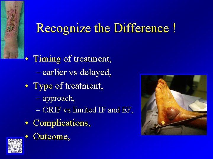 Recognize the Difference ! • Timing of treatment, – earlier vs delayed, • Type