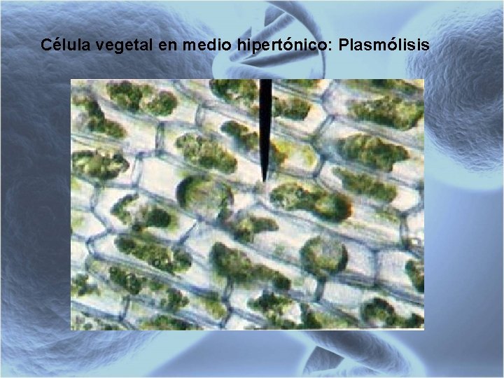 Célula vegetal en medio hipertónico: Plasmólisis 