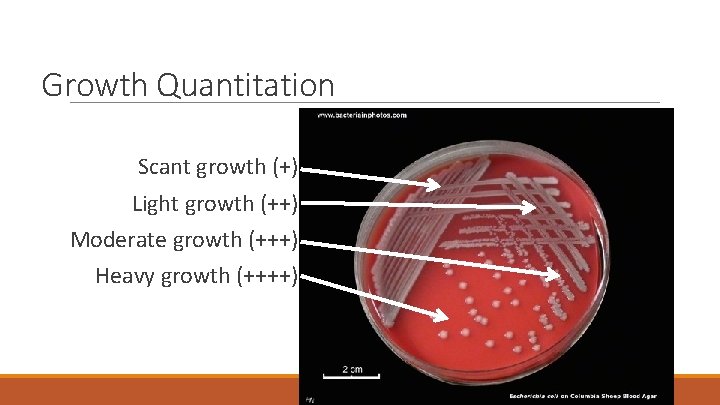 Growth Quantitation Scant growth (+) Light growth (++) Moderate growth (+++) Heavy growth (++++)