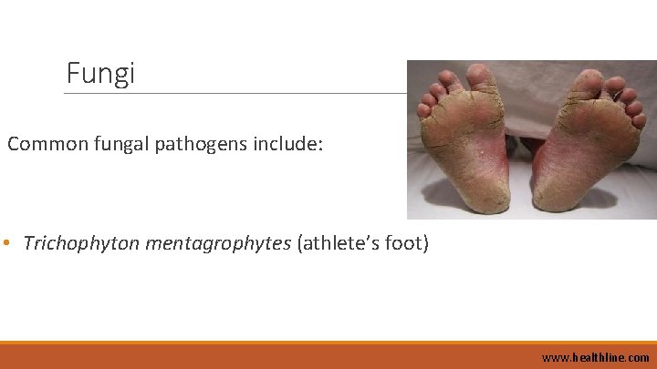 Fungi Common fungal pathogens include: • Trichophyton mentagrophytes (athlete’s foot) www. healthline. com 
