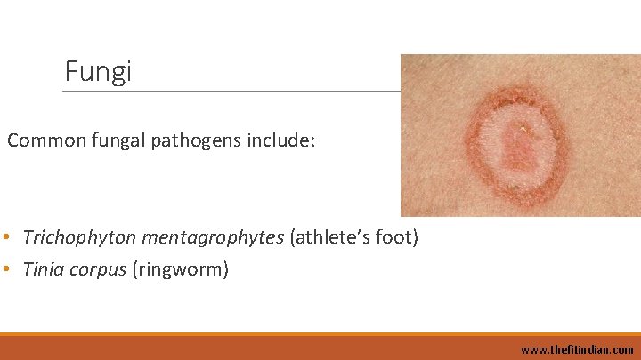 Fungi Common fungal pathogens include: • Trichophyton mentagrophytes (athlete’s foot) • Tinia corpus (ringworm)