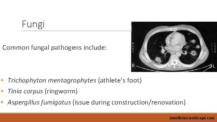 Fungi Common fungal pathogens include: • Trichophyton mentagrophytes (athlete’s foot) • Tinia corpus (ringworm)