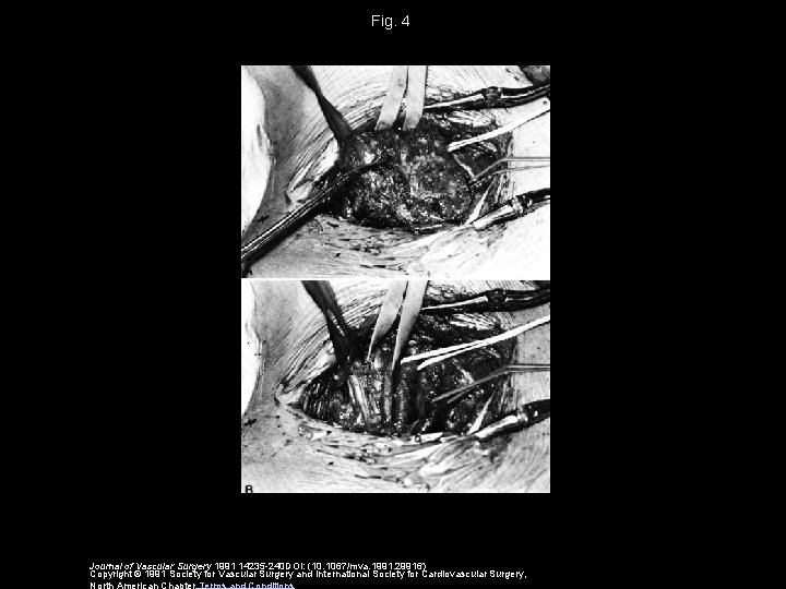 Fig. 4 Journal of Vascular Surgery 1991 14235 -240 DOI: (10. 1067/mva. 1991. 29916)