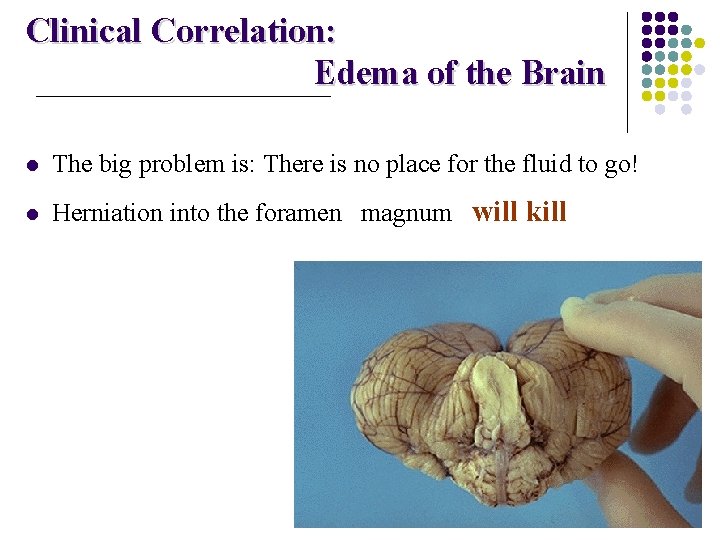 Clinical Correlation: Edema of the Brain l The big problem is: There is no