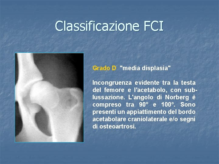 Classificazione FCI Grado D "media displasia" Incongruenza evidente tra la testa del femore e