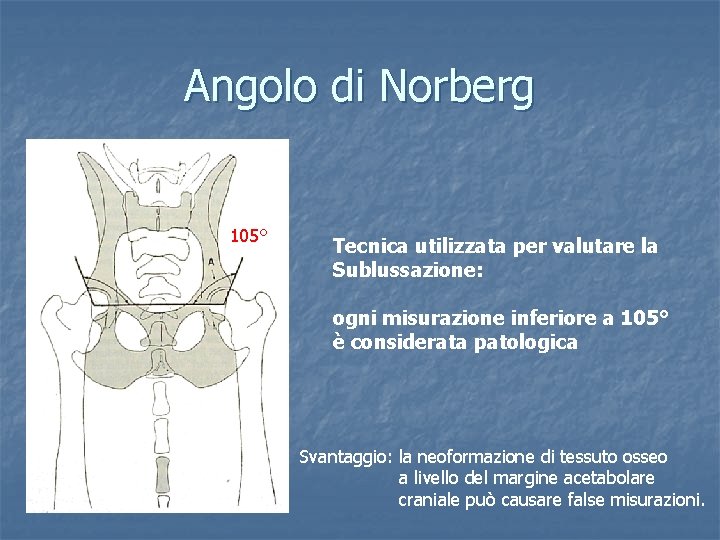 Angolo di Norberg 105° Tecnica utilizzata per valutare la Sublussazione: ogni misurazione inferiore a