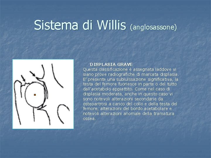 Sistema di Willis (anglosassone) DISPLASIA GRAVE Questa classificazione è assegnata laddove vi siano prove