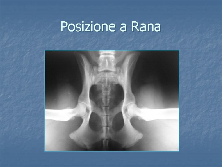 Posizione a Rana 