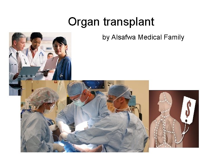 Organ transplant by Alsafwa Medical Family 