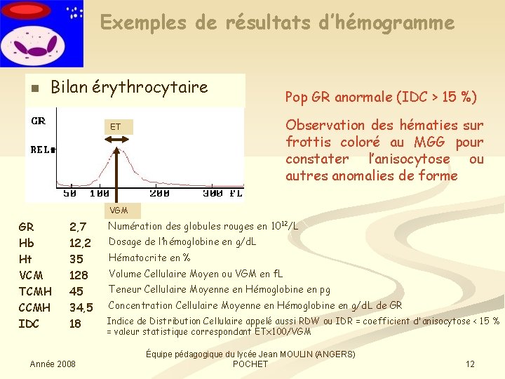 Exemples de résultats d’hémogramme n Bilan érythrocytaire Pop GR anormale (IDC > 15 %)