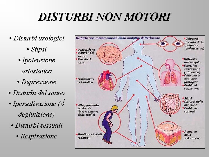 DISTURBI NON MOTORI • Disturbi urologici • Stipsi • Ipotensione ortostatica • Depressione •