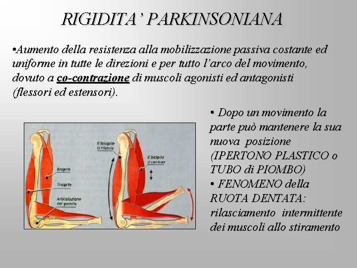 RIGIDITA’ PARKINSONIANA • Aumento della resistenza alla mobilizzazione passiva costante ed uniforme in tutte