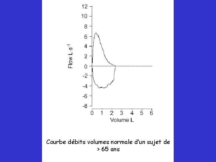 Courbe débits volumes normale d’un sujet de > 65 ans 