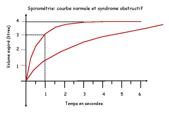 Spirométrie: courbe normale et syndrome obstructif Volume expiré (litres) 4 3 2 1 1