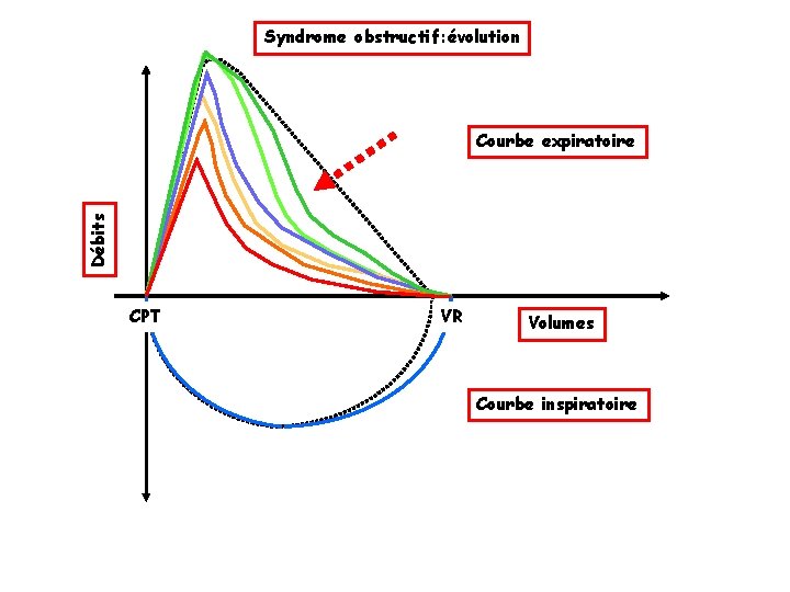 Syndrome obstructif: évolution Débits Courbe expiratoire CPT VR Volumes Courbe inspiratoire 