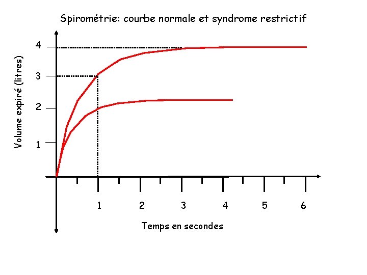 Spirométrie: courbe normale et syndrome restrictif Volume expiré (litres) 4 3 2 1 1