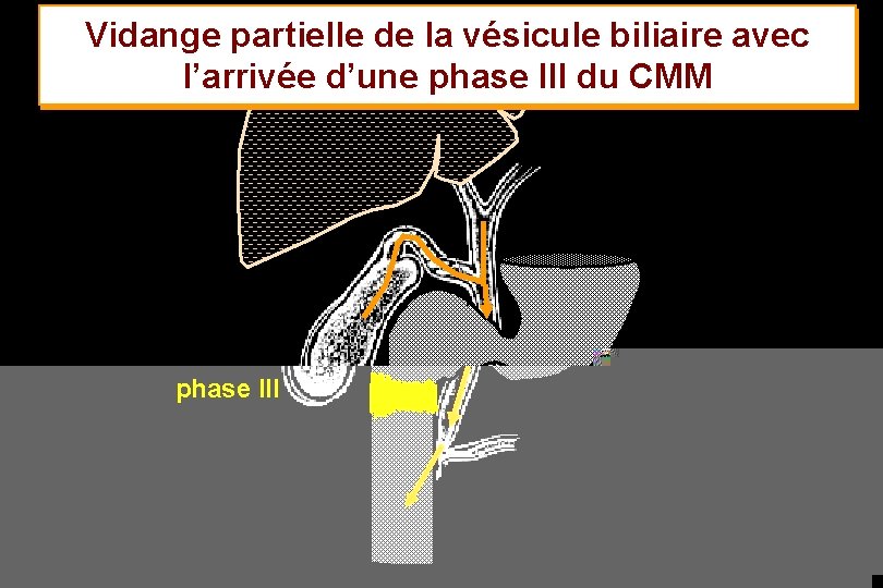 Vidange partielle de la vésicule biliaire avec l’arrivée d’une phase III du CMM phase
