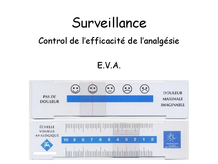 Surveillance Control de l’efficacité de l’analgésie E. V. A. 