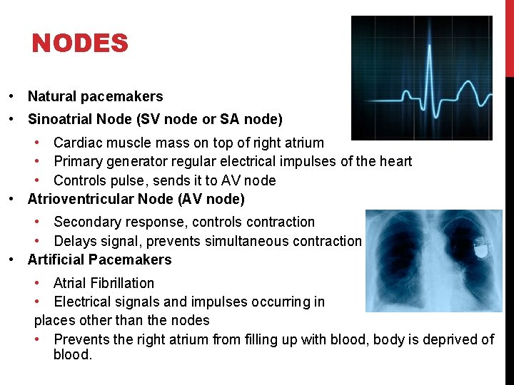 NODES • Natural pacemakers • Sinoatrial Node (SV node or SA node) • Cardiac