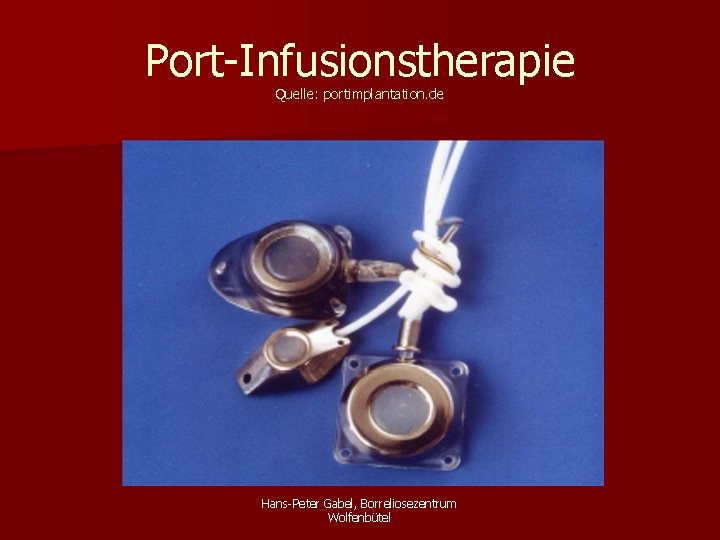 Port-Infusionstherapie Quelle: portimplantation. de Hans-Peter Gabel, Borreliosezentrum Wolfenbütel 