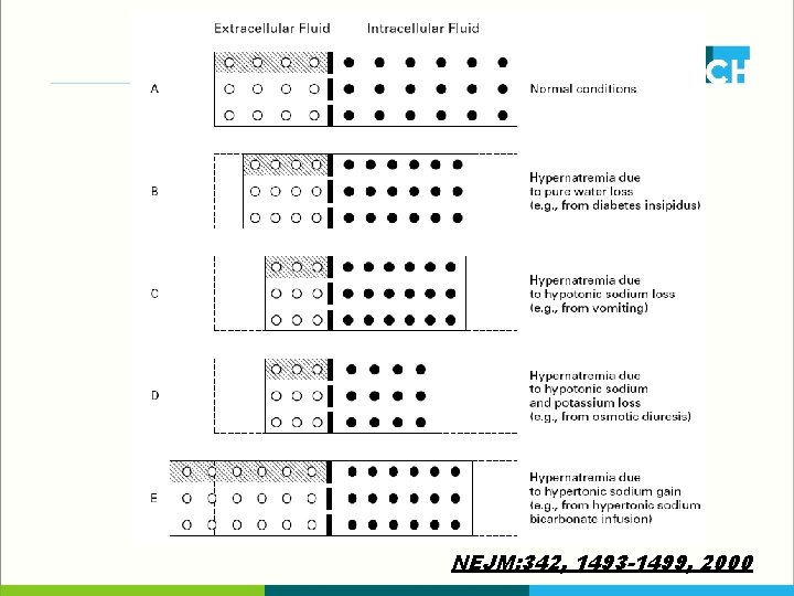 NEJM: 342, 1493 -1499, 2000 NEJM: 342, 1493 -1499, 2000